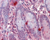 IHC testing of FFPE human small intestine tissue with RGS1 antibody at 2.5ug/ml. Required HIER: steamed antigen retrieval with pH6 citrate buffer; AP-staining.