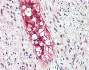 IHC testing of FFPE human vessel with ECSM2 antibody at 5ug/ml. Required HIER: steamed antigen retrieval with pH6 citrate buffer; AP-staining.