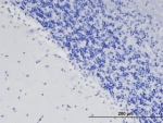 IHC staining of FFPE human cerebellum with ODZ3 antibody at 1.5ug/ml. HIER: steamed with pH6 citrate buffer, AP-staining. Nuclear staining of the granular cell layer is seen.