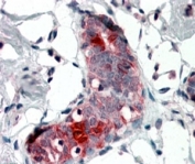 Mammaglobin A Antibody Goat Polyclonal - immunohistochemistry of human breast tissue. FFPE human breast tissue was stained with Mammaglobin A Antibody Goat Polyclonal at 4 ug/ml to detect Mammaglobin A / SCGB2A2. Red chromogenic signal highlights cytoplasmic staining in mammary epithelial cells within glandular structures, consistent with the secretory localization of this breast-associated protein. Surrounding stromal cells show little to no staining. Heat-induced epitope retrieval was performed by steaming tissue sections in pH6 citrate buffer prior to AP-based chromogenic detection.