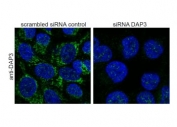 DAP3 Antibody Knockdown IF. Immunofluorescence analysis of guanidinium thiocyanate-treated human HeLa cells stained with goat polyclonal DAP3 antibody before (left) and after (right) siRNA-mediated DAP3 knockdown. DAP3 signal is detected with DyLight 488 (green) and nuclei are counterstained with DAPI (blue). Reduced cytoplasmic punctate fluorescence following siRNA treatment supports specific detection of Death-associated protein 3 / DAP3, a mitochondrial protein involved in apoptotic signaling and mitochondrial ribosomal function.