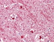 DAP3 Antibody Brain Immunohistochemistry. IHC testing of FFPE human brain cortex tissue with DAP3 antibody at 2.5ug/ml. Required HIER: steamed antigen retrieval with pH6 citrate buffer; AP-staining.