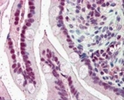 IHC staining of FFPE human small intestine with KPNA4 antibody at 5ug/ml. HIER: steamed with pH6 citrate buffer, AP-staining.
