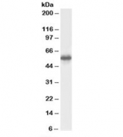 Western blot testing of human testis lysate with CSN1 antibody at 0.5ug/ml. Predicted molecular weight: ~58kDa.