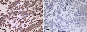 CD32 Antibody Placenta IHC. Immunohistochemistry analysis of FFPE human placental tissue stained with CD32 Antibody / Low-Affinity Fc Gamma Receptor at 8 ug/ml following HIER in pH 6 citrate buffer. Distinct HRP-DAB brown membranous and cytoplasmic staining is observed in placental trophoblast-associated cell populations, consistent with expression of FCGR2 / CD32, an Fc receptor involved in immune complex recognition and regulation of antibody-mediated immune signaling. The negative control section processed without primary antibody shows minimal background staining.