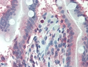 IHC testing of FFPE human small intestine tissue with LASP1 antibody at 2.5ug/ml. Steamed antigen retrieval with citrate buffer pH 6, AP-staining.