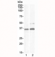 PAX8 Antibody for WB / Paired Box Protein Pax-8 Western Blot Antibody western blot analysis in human samples. Lane 1: human kidney lysate, Lane 2: human HeLa cell lysate. A band is detected at approximately 48 kDa, consistent with the predicted molecular weight of Paired box protein Pax-8 (PAX8). Additional bands between ~31-43 kDa correspond to known PAX8 isoforms, while a higher band near ~62 kDa may reflect post-translationally modified forms of the protein, such as phosphorylation-dependent mobility shifts. The banding pattern aligns with reported isoform diversity and transcription factor regulation, supporting specific detection of PAX8 across different human cell types.