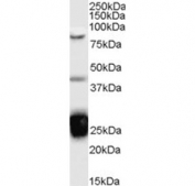 Western blot testing of Jurkat cell lysate with TIA1 antibody at 0.1ug/ml. Predicted molecular weight: ~43 kDa, ~42 kDa and ~24 kDa (three isoforms).