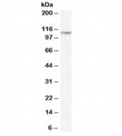 CD26 Antibody WB. Western blot testing of rat lung lysate with CD26 antibody at 0.3ug/ml. Predicted molecular weight: ~88 kDa (unmodified), ~110 kDa (glycosylated).