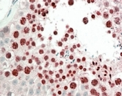 HOXA10 Antibody Human Testis IHC. IHC staining of FFPE human testis with HOXA10 antibody demonstrated strong nuclear staining in germ cells within the seminiferous tubules, consistent with the role of HOXA10 as a homeobox transcription factor that regulates developmental gene expression and cellular differentiation. HOXA10 is best known for its essential functions during embryogenesis and reproductive tract development, while continued expression in adult reproductive tissues supports roles in germ cell biology, fertility, and tissue homeostasis. The predominantly nuclear staining pattern is consistent with the transcriptional regulatory function of HOXA10. HIER was performed by steaming tissue sections in pH 6 citrate buffer prior to AP-based detection. These results support the utility of HOXA10 Antibody for studies of developmental biology, reproductive biology, stem cell regulation, and transcriptional control.