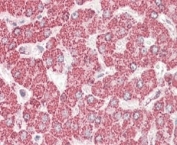 IHC staining of FFPE human liver with ETFB antibody at 4ug/ml. HIER: steamed with pH6 citrate buffer, AP-staining.