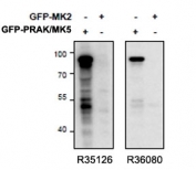 MAPKAPK5 Antibody Overexpression WB. Western blot testing of HEK293 cell lysates expressing mouse MK5 / PRAK or mouse MK2 using goat polyclonal MAPKAPK5 antibody Cat. # R35126 (0.5 ug/ml). The antibody recognizes a prominent band corresponding to MK5/PRAK-GFP while showing minimal signal in MK2-expressing lysates, supporting selective detection of MAP kinase-activated protein kinase 5 / PRAK relative to the related MK2 kinase.