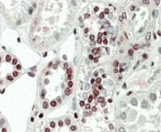 MAPKAPK5 Antibody Kidney IHC. Immunohistochemistry analysis of FFPE human kidney tissue stained with goat polyclonal MAPKAPK5 antibody at 5 ug/ml. Following HIER in pH 6 citrate buffer, prominent AP-red nuclear staining is observed in renal tubular epithelial cells, consistent with the known stress-responsive and ERK3-associated signaling functions of MAPKAPK5 / PRAK.
