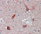 CAMK2A Antibody Human Brain Cortex IHC. Immunohistochemical staining of FFPE human brain cortex tissue with CAMK2A antibody at 4 ug/ml using alkaline phosphatase (AP) detection. Heat-induced epitope retrieval (HIER) was performed by steaming tissue sections in pH 6 citrate buffer prior to staining. CAMK2A immunoreactivity is observed predominantly within cortical neurons and the surrounding neuropil, consistent with the expected distribution of Calcium/Calmodulin Dependent Protein Kinase II Alpha (CAMK2A), a neuronal serine/threonine kinase that regulates calcium-dependent signaling, synaptic plasticity, learning, and memory.