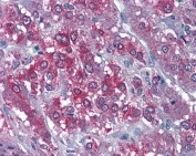 CAMK2A Antibody Human Adrenal Gland IHC. Immunohistochemical staining of FFPE human adrenal gland tissue with CAMK2A antibody at 3.75 ug/ml using alkaline phosphatase (AP) detection. Heat-induced epitope retrieval (HIER) was performed by steaming tissue sections in pH 6 citrate buffer prior to staining. CAMK2A immunoreactivity is observed predominantly within the cytoplasm of adrenal cortical cells, consistent with the expected expression of Calcium/Calmodulin Dependent Protein Kinase II Alpha (CAMK2A), a calcium signaling kinase that regulates calcium-dependent signal transduction, protein phosphorylation, and stimulus-responsive cellular signaling pathways.