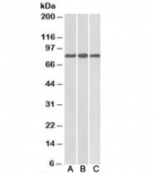 Western blot testing of mouse heart [A], rat heart [B], and rat kidney [C] lysates with MID2 antibody at 0.1ug/ml. Predicted molecular weight: ~80kDa.