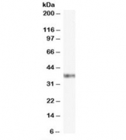 GBX2 Antibody Jurkat WB. Western blot analysis of Jurkat cell lysate using GBX2 Antibody / Developmental Patterning Protein Antibody demonstrates a distinct band at approximately 37 kDa, consistent with the predicted molecular weight of Gastrulation brain homeobox 2 / GBX2, a developmental homeobox transcription factor involved in embryonic patterning and lineage-associated transcriptional regulation. The observed expression pattern supports the role of GBX2 in developmental signaling and tissue differentiation-associated regulatory pathways.