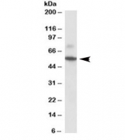 Western blot analysis of Peripherin/PRPH antibody in rat colon lysate. A distinct band is observed at approximately 55 kDa, consistent with the predicted molecular weight of Peripherin based on amino acid sequence. An additional band of slightly different mobility is also detected, which may represent an alternative isoform, post-translational modification, or differential processing of PRPH. Both bands are specifically blocked by pre-incubation with the immunizing peptide, supporting target specificity of the antibody.