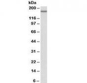Western blot testing of HeLa lysate with EGFR antibody at 0.1ug/ml. Predicted molecular weight ~134kDa. The higher band likely represents a glycosylated form of the protein.