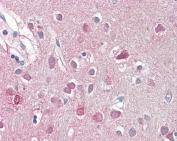 IHC testing of FFPE human brain cortex with ORC3L antibody at 3.75ug/ml. Required HIER: steamed antigen retrieval with pH6 citrate buffer; AP-staining.