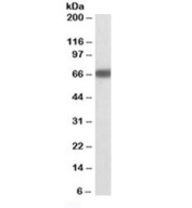 GAD67 Antibody Mouse Brain WB. Western blot testing of mouse brain lysate with GAD67 antibody at 1ug/ml. Predicted molecular weight ~67 kDa.