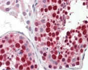 IHC testing of FFPE human testis tissue with ABCA9 antibody at 5ug/ml. Required HIER: steamed antigen retrieval with pH6 citrate buffer; AP-staining.