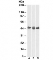 CD27 Antibody for WB. Western blot analysis of CD27 / TNFRSF7 expression in human lymphoid tissues using Lymphoid Expression CD27 Western Blot Antibody. Lane A: human spleen lysate, Lane B: human tonsil lysate, Lane C: human thymus lysate. A band is detected at approximately 45 kDa, consistent with the glycosylated form of CD27, alongside a lower predicted molecular weight of approximately 29 kDa for the core protein. CD27 is a glycosylated receptor, and the observed higher molecular weight band reflects N-linked glycosylation commonly present in lymphocyte-derived tissues. The consistent signal across spleen, tonsil, and thymus aligns with the known enrichment of CD27 in T cells and memory B cells.