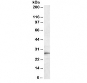 Western blot testing of mouse liver lysate with Trem2 antibody at 0.3ug/ml. Predicted molecular weight ~25 kDa.