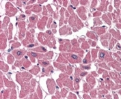IHC staining of FFPE human heart with ABTB1 antibody at 4ug/ml. HIER: steamed with pH6 citrate buffer, AP-staining.