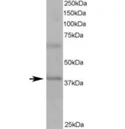 Western blot testing of human heart lysate with ABTB1 antibody at 1ug/ml. Predicted molecular weight ~38/54 kDa (isoforms 1/2).