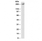Western blot testing of human heart lysate with CACNA1C antibody at 1ug/ml. Predicted molecular weight: ~249kDa, observed here at ~200kDa.