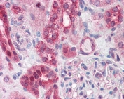 IHC testing of FFPE human kidney tissue with ABCD4 antibody at 3.75ug/ml. Required HIER: steamed antigen retrieval with pH6 citrate buffer; AP-staining.