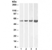 Desmin Antibody Human/Mouse/Rat/Pig WB. Western blot testing of 1) human, 2) mouse, 3) rat and 4) pig skeletal muscle lysate with Desmin antibody at 1ug/ml. Predicted molecular weight ~54 kDa.