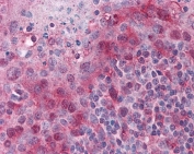 TMS1 / PYCARD Antibody Human Tonsil IHC. Immunohistochemical staining of FFPE human tonsil using TMS1 Antibody / PYCARD at 2.5 ug/ml. PYCARD expression is detected predominantly within the cytoplasm of lymphoid cells, consistent with its role as an inflammasome adaptor protein involved in innate immune signaling, inflammatory cytokine maturation, and pyroptotic cell death. Heat-induced epitope retrieval was performed by steaming sections in pH 6 citrate buffer prior to AP-based immunostaining.