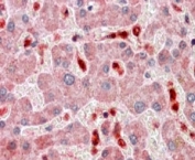 TMS1 Antibody / PYCARD Human Liver IHC. Immunohistochemical staining of FFPE human liver using TMS1 Antibody / PYCARD at 2.5 ug/ml. PYCARD expression is observed predominantly within the cytoplasm of hepatocytes, consistent with its function as an inflammasome adaptor protein involved in innate immune signaling, inflammatory responses, and regulation of programmed cell death. Heat-induced epitope retrieval was performed by steaming sections in pH 6 citrate buffer prior to AP-based immunostaining.