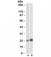 CD3e Antibody. Western blot analysis of CD3 Epsilon / CD3E antibody using CD3e Antibody / T Lymphocyte Identification Marker Antibody in human cell lysates. Lane A: Jurkat cell lysate, Lane B: Molt-4 cell lysate. A band is detected at approximately 23 kDa in both samples, consistent with the predicted molecular weight of CD3 epsilon. The presence of a clear band in both T-cell-derived lysates supports reliable detection of CD3E and confirms its utility as a marker for T lymphocyte identification.