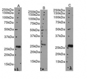 Western blot testing of human A) heart, B) skin and C) duodenum tissue lysate with EGLN3 antibody at 0.5ug/ml. Predicted molecular weight: ~27 kDa.