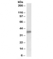Delta-Sarcoglycan Antibody Human Heart WB. Western blot analysis of human heart lysate using Delta-Sarcoglycan Antibody / SGCD Antibody. Protein was detected with the primary antibody at 0.1 ug/ml. A distinct band is observed at approximately 35 kDa, consistent with the predicted molecular weight of delta-sarcoglycan. The strong signal in heart tissue is consistent with the abundant expression of SGCD in cardiac muscle, where it functions as a core component of the sarcoglycan complex within the dystrophin-associated glycoprotein complex. This Delta-Sarcoglycan Antibody, also called SGCD Antibody, is suitable for studies of sarcoglycan biology, muscle membrane stability, muscular dystrophy, and cardiac and skeletal muscle physiology.