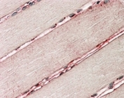 Delta-Sarcoglycan Antibody Human Skeletal Muscle IHC. Immunohistochemical analysis of FFPE human skeletal muscle using Delta-Sarcoglycan Antibody / SGCD Antibody. Heat-induced epitope retrieval was performed by steaming tissue sections in pH6 citrate buffer, followed by alkaline phosphatase-based detection. The primary antibody was applied at 3.8 ug/ml. Distinct sarcolemmal staining outlines individual skeletal muscle fibers, consistent with the expected membrane localization of delta-sarcoglycan within the sarcoglycan complex. This Delta-Sarcoglycan Antibody, also called SGCD Antibody, is suitable for studies of sarcoglycan biology, muscle membrane stability, dystrophin-associated protein complexes, and skeletal and cardiac muscle physiology.