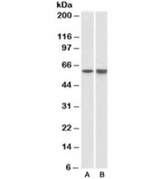 LCK Antibody Pig Bone Marrow Spleen WB. Western blot of pig bone marrow (A) and spleen (B) lysates with LCK antibody at 1ug/ml.