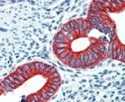 IHC staining of FFPE human uterus with EPB41L2 antibody at 2.5ug/ml. HIER: steamed with pH6 citrate buffer, AP-staining.