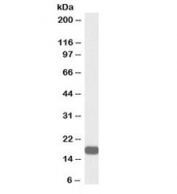 VHL Antibody Biotin Conjugate Human Ovary WB. Western blot analysis of human ovary lysate using biotinylated VHL antibody demonstrates detection of an immunoreactive band at approximately 19 kDa, consistent with the expected molecular weight of the shorter Von Hippel-Lindau protein (VHL) isoform. VHL is a tumor suppressor protein that regulates hypoxia-inducible factor (HIF) signaling and serves as a central component of cellular oxygen-sensing pathways. Through its role in an E3 ubiquitin ligase complex, VHL helps control cellular responses to oxygen availability, angiogenesis, and metabolic adaptation. The observed band supports the utility of this biotin-conjugated antibody for studies of hypoxia signaling, tumor suppression, and oxygen homeostasis pathways. Western blot was performed using 0.3 ug/ml primary antibody. Predicted molecular weights: ~23 kDa (isoform 1) and ~19 kDa (isoform 2).