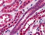 IHC testing of FFPE human kidney with STXBP6 antibody at 4ug/ml. HIER: steamed with pH6 citrate buffer, AP-staining.