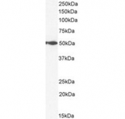 Western blot testing of human spleen tissue lysate with IFNGR1 antibody at 2ug/ml. Predicted molecular weight: ~54 kDa (unmodified), 80-100 kDa (glycosylated).