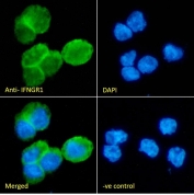 IF/ICC staining of fixed and permeabilized human ThP1 cells with IFNGR1 antibody (green) at 10ug/ml and DAPI nuclear stain (blue).