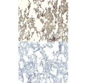 IHC staining of FFPE human lung tissue (left) and negative control without primary (right) with IFNGR1 antibody at 4ug/ml. Required HIER: steamed antigen retrieval with pH6 citrate buffer; HRP-staining.