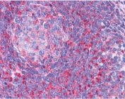 IHC testing of FFPE human spleen tissue with TPD52L2 antibody at 3.75ug/ml. Required HIER: steamed antigen retrieval with pH6 citrate buffer; AP-staining.