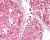 IHC testing of FFPE human testis tissue with MCT2 antibody at 2.5ug/ml. HIER: steamed antigen retrieval with pH6 citrate buffer; AP-staining.