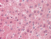 IHC testing of FFPE human liver tissue with ALDH6A1 antibody at 5ug/ml. Required HIER: steamed antigen retrieval with pH6 citrate buffer; AP-staining.