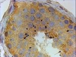PIWIL1 Antibody Human Testis IHC. Immunohistochemistry staining of FFPE human testis using PIWIL1 Antibody / Testicular Germ Cell Marker Antibody demonstrates strong cytoplasmic HRP-DAB brown staining within seminiferous tubule germ cell populations. The staining pattern is consistent with expression of PIWIL1 (HIWI), a member of the PIWI family of Argonaute proteins that regulates piRNA-mediated gene silencing, transposon suppression, genome stability, and germ cell development. PIWIL1 is highly associated with spermatogenesis and germline maintenance, making it a valuable marker for studies of reproductive biology, fertility, and germ cell differentiation. HIER was performed by steaming tissue sections in pH 6 citrate buffer prior to immunostaining. Primary antibody was applied at 4 ug/ml and detected using an HRP-DAB staining system.